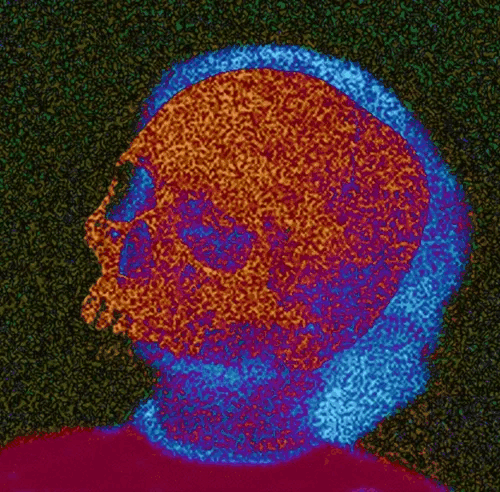 SkullBoy