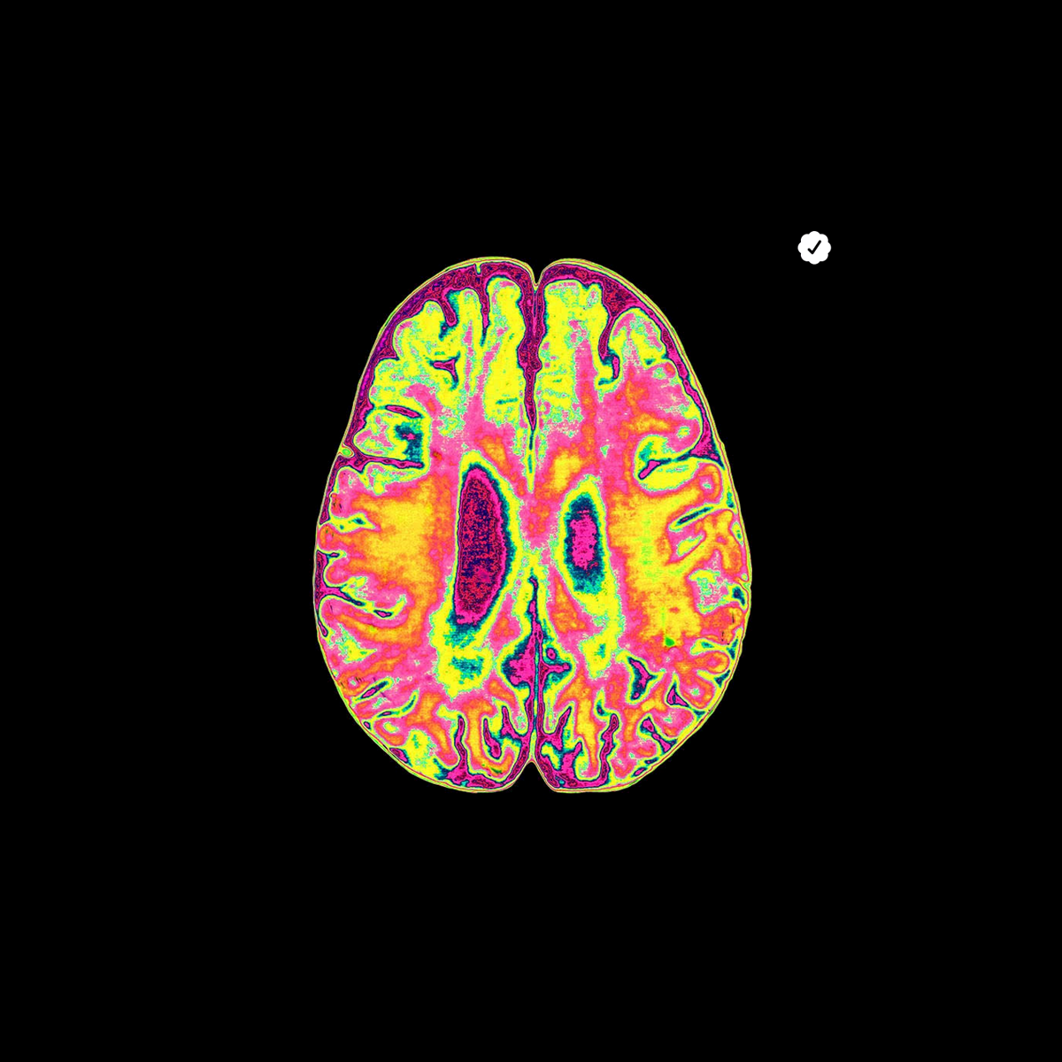 🧠 ✔️