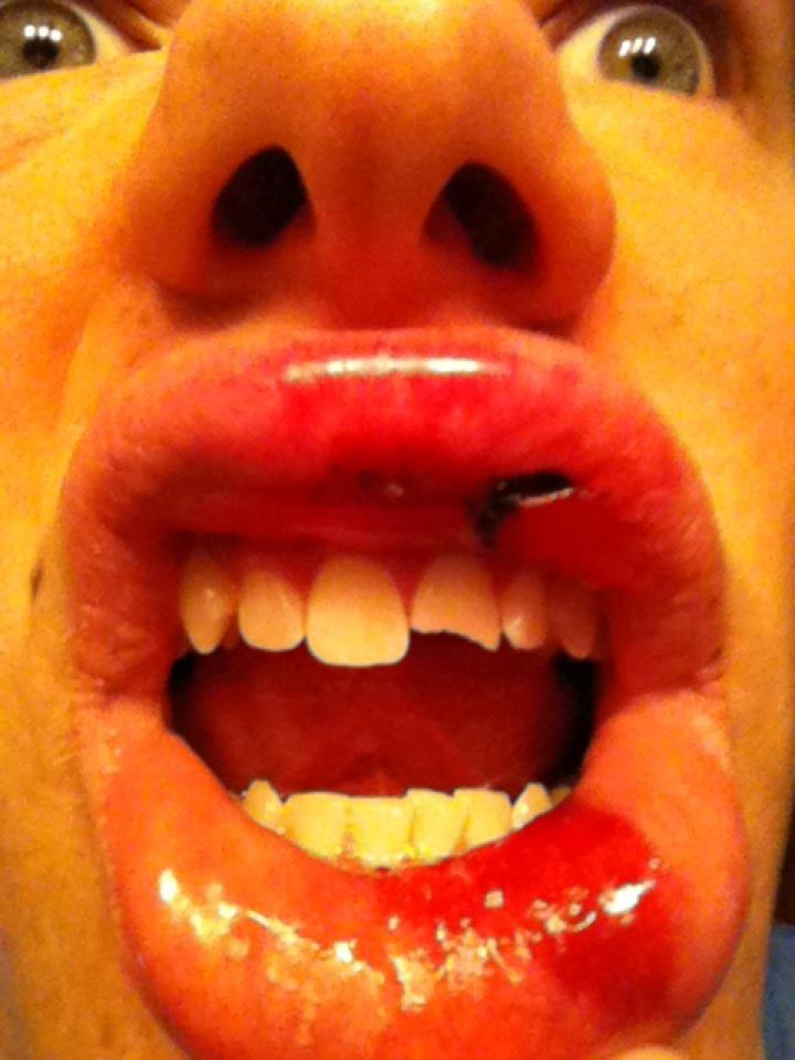 Busted Mouth
