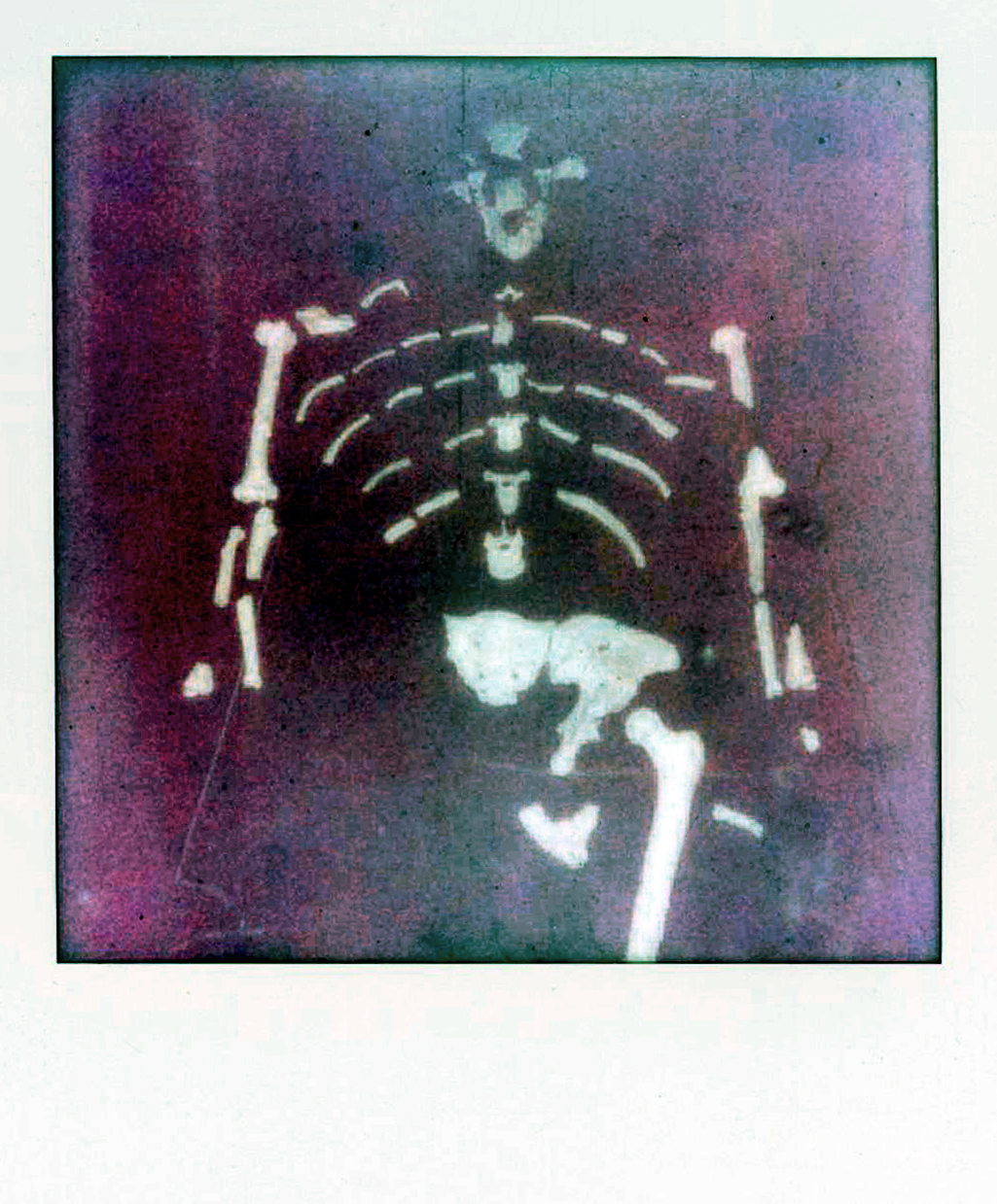 NOT DED