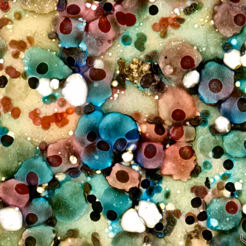 Oncocytes