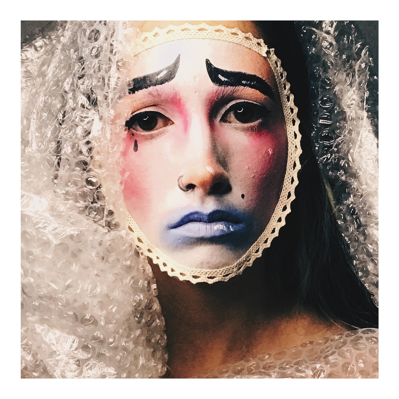 Pain