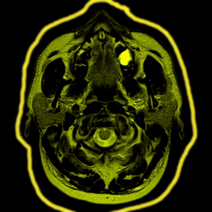 xBrain