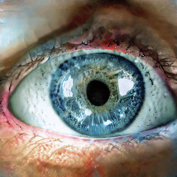 Eyes