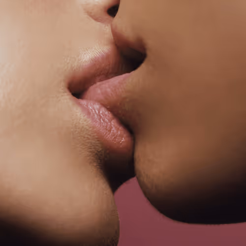 Kiss