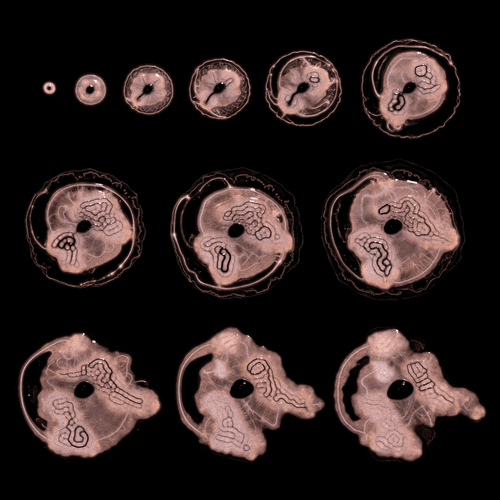 Embryogenesis #86