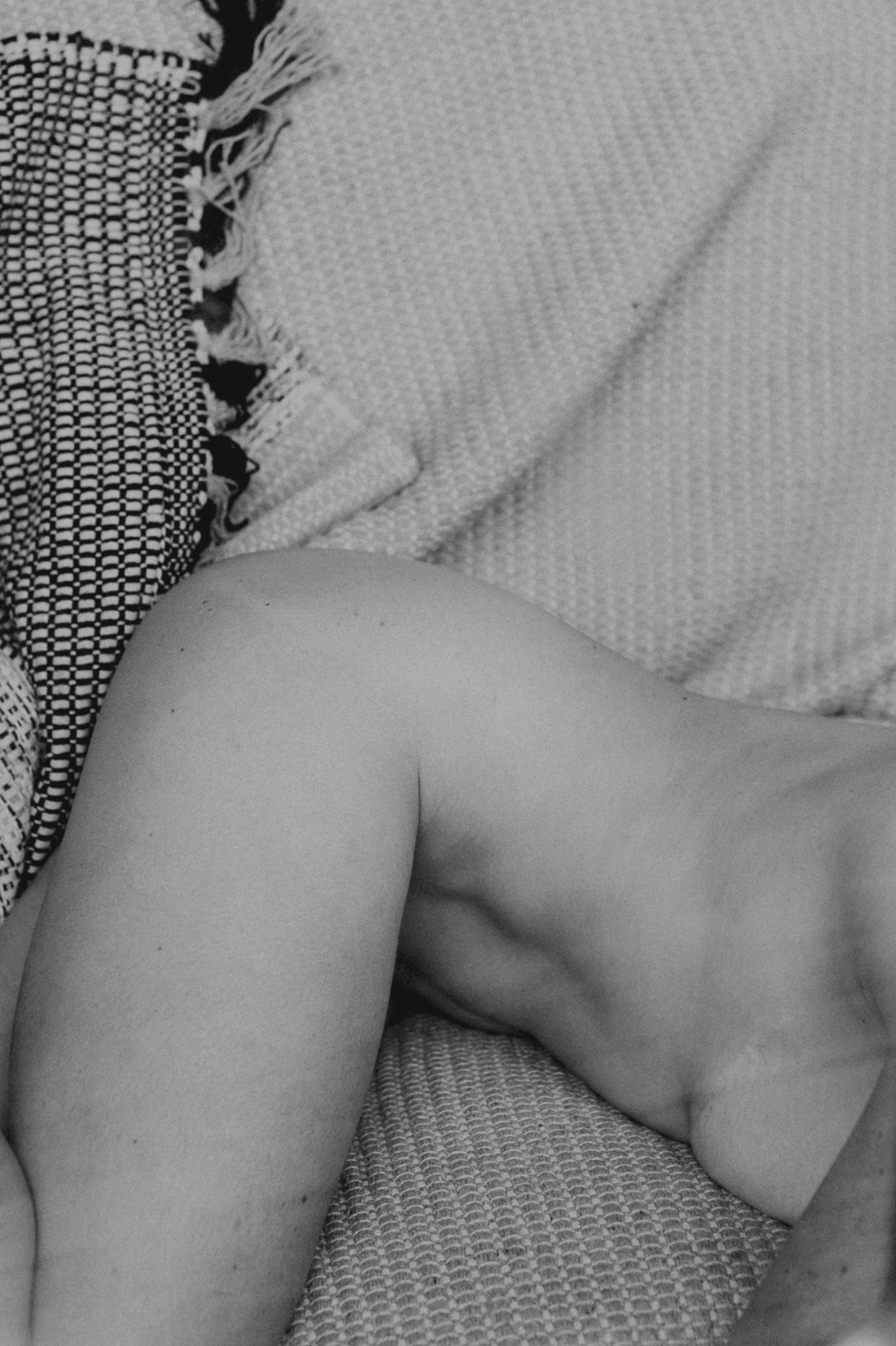 Skin Story #14