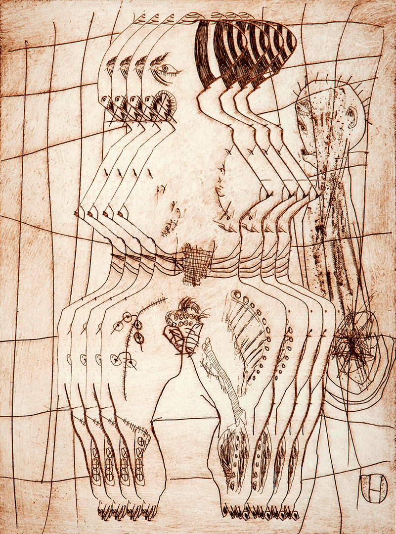 Incisions 10