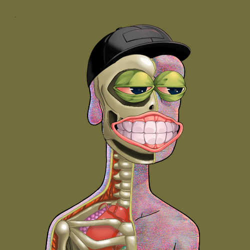 Anatomy Rare Apepe YC #4027