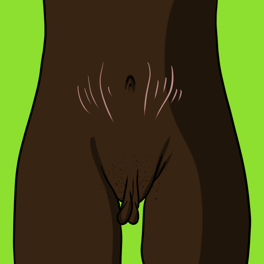 My Body #31