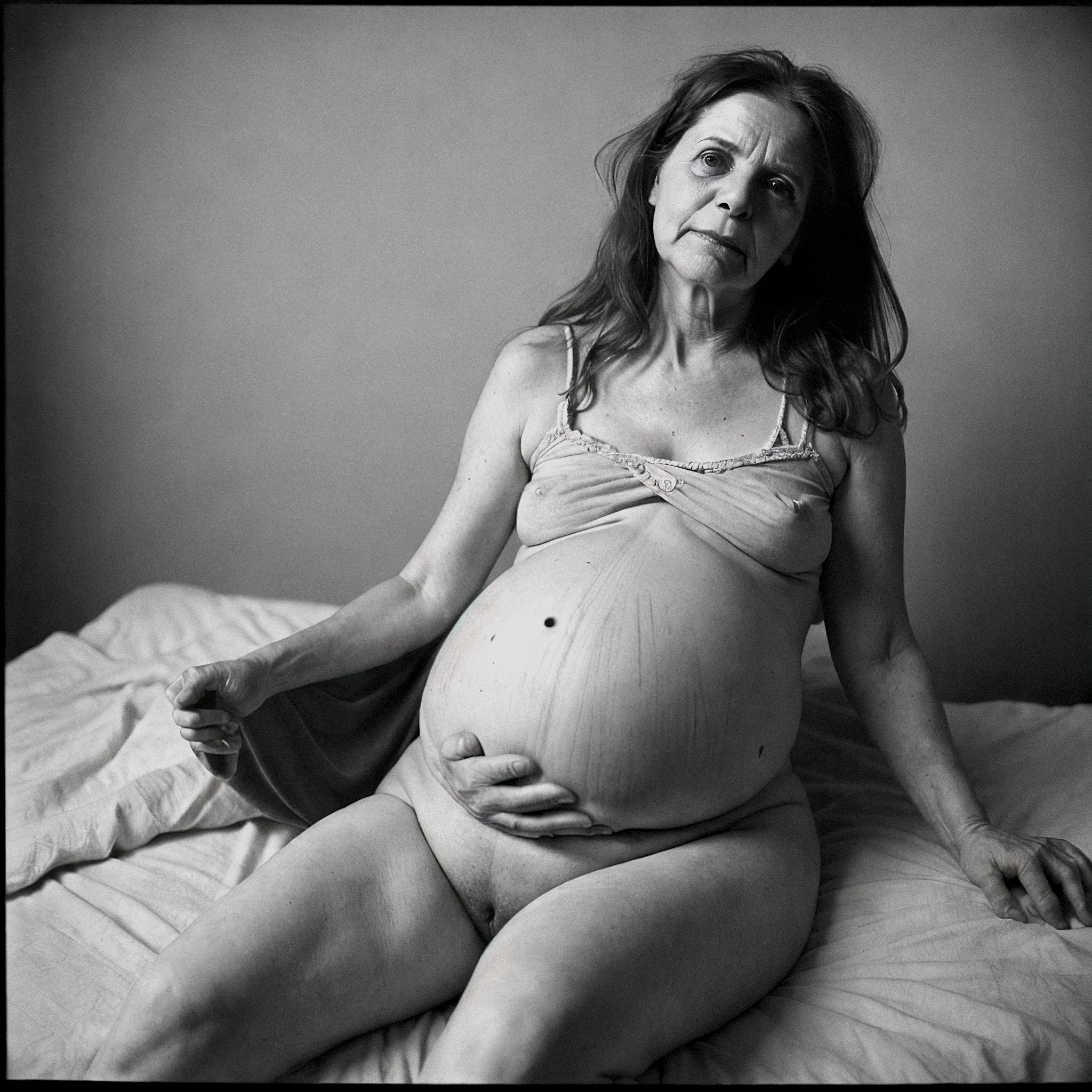 advanced maternal age