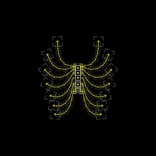 Ortheza Ocerocosmoides