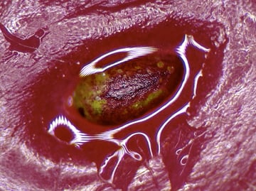 The Interfered Microscopy Plot #37