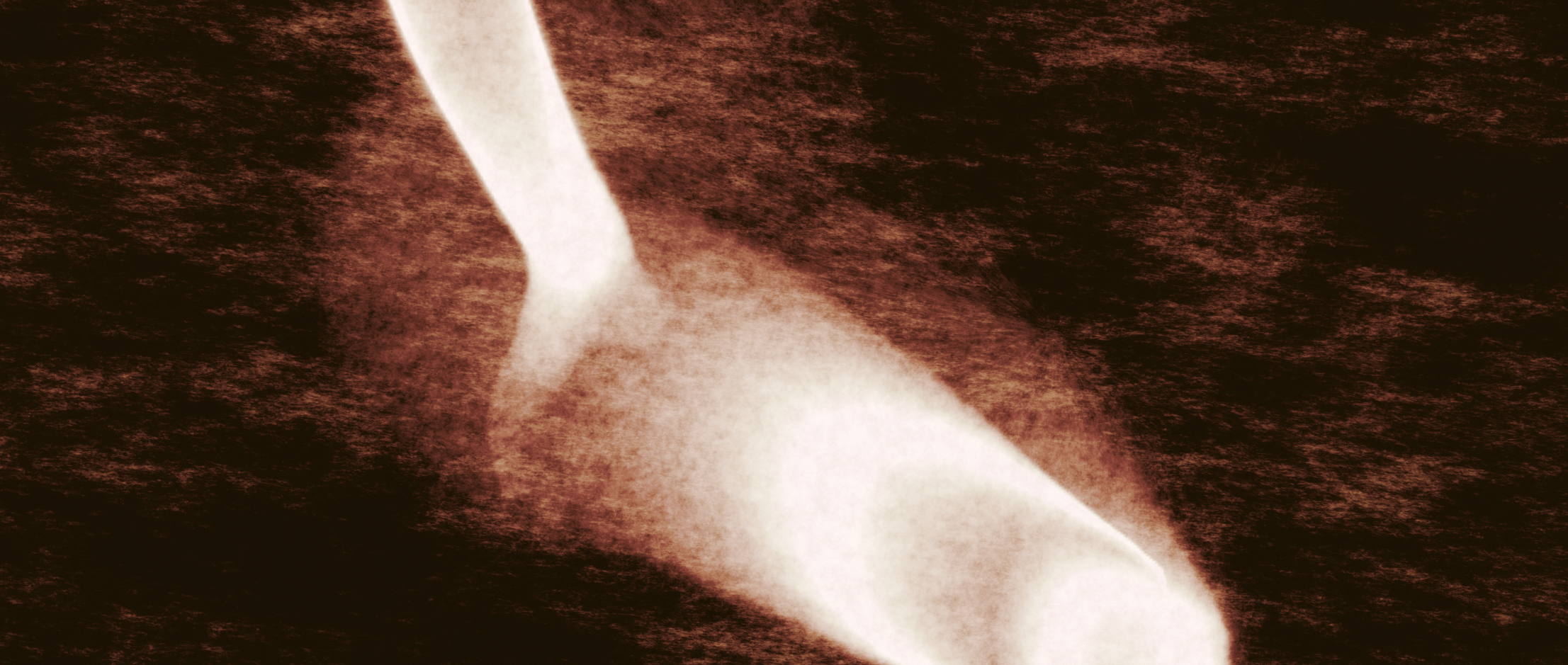 ultrasound wand
