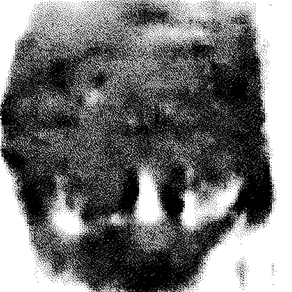 Tooth