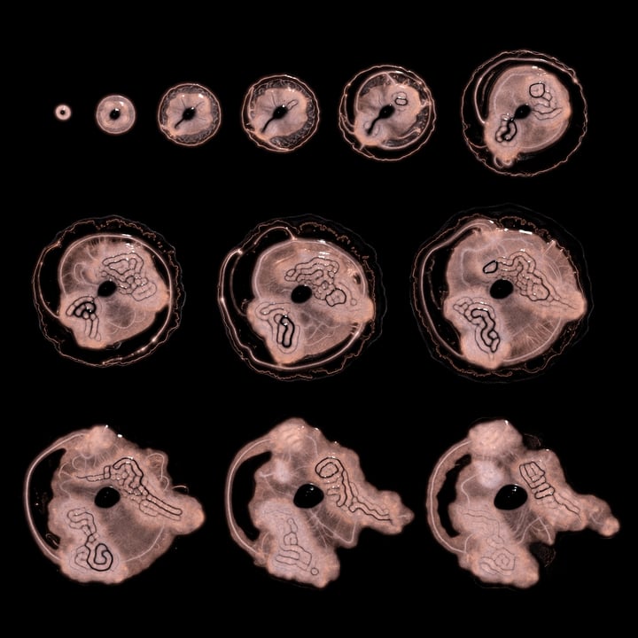 Embryogenesis #7