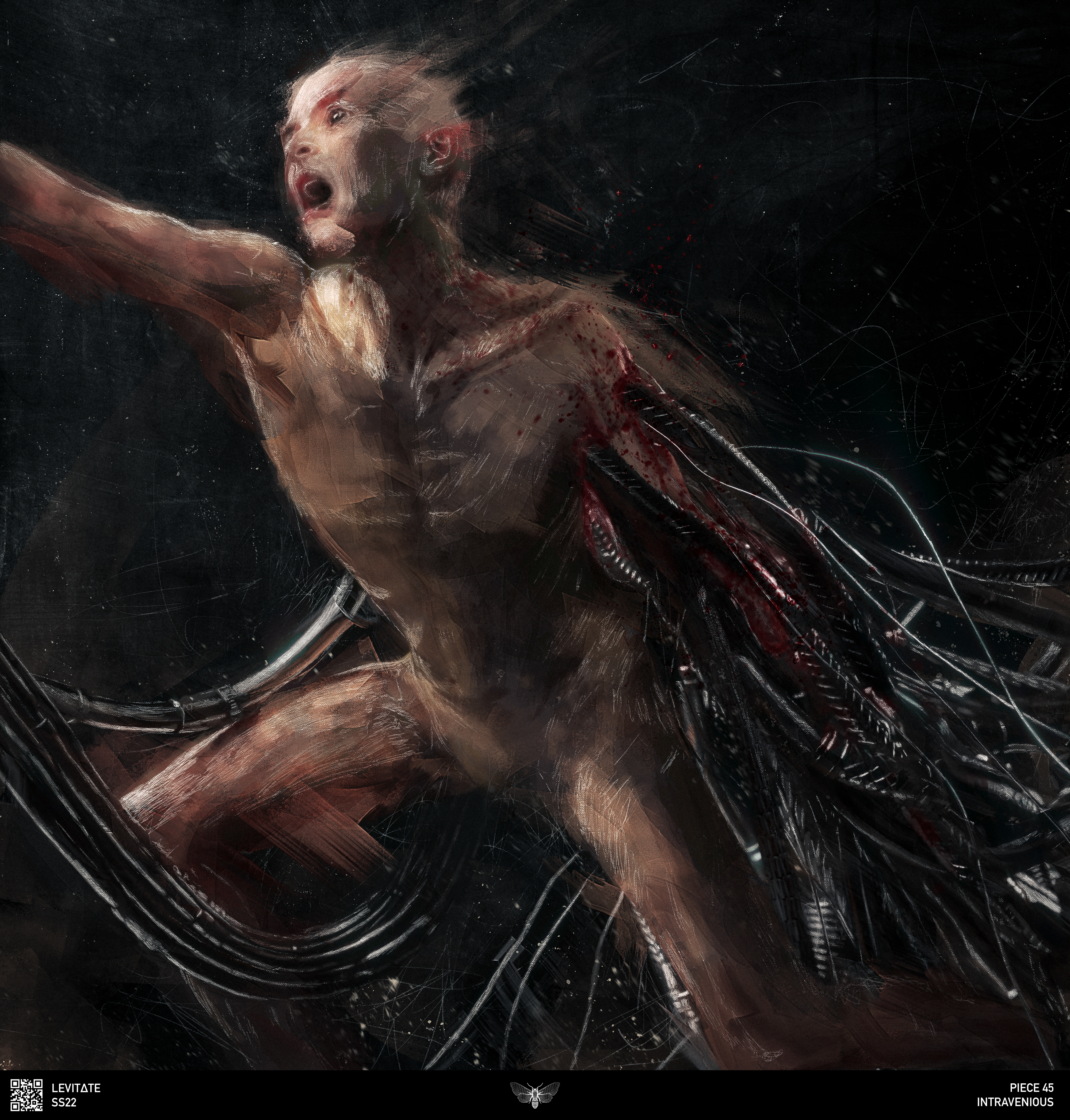 Intravenous