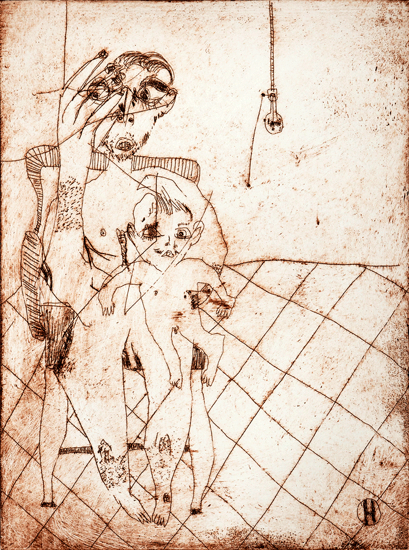 Incisions 6