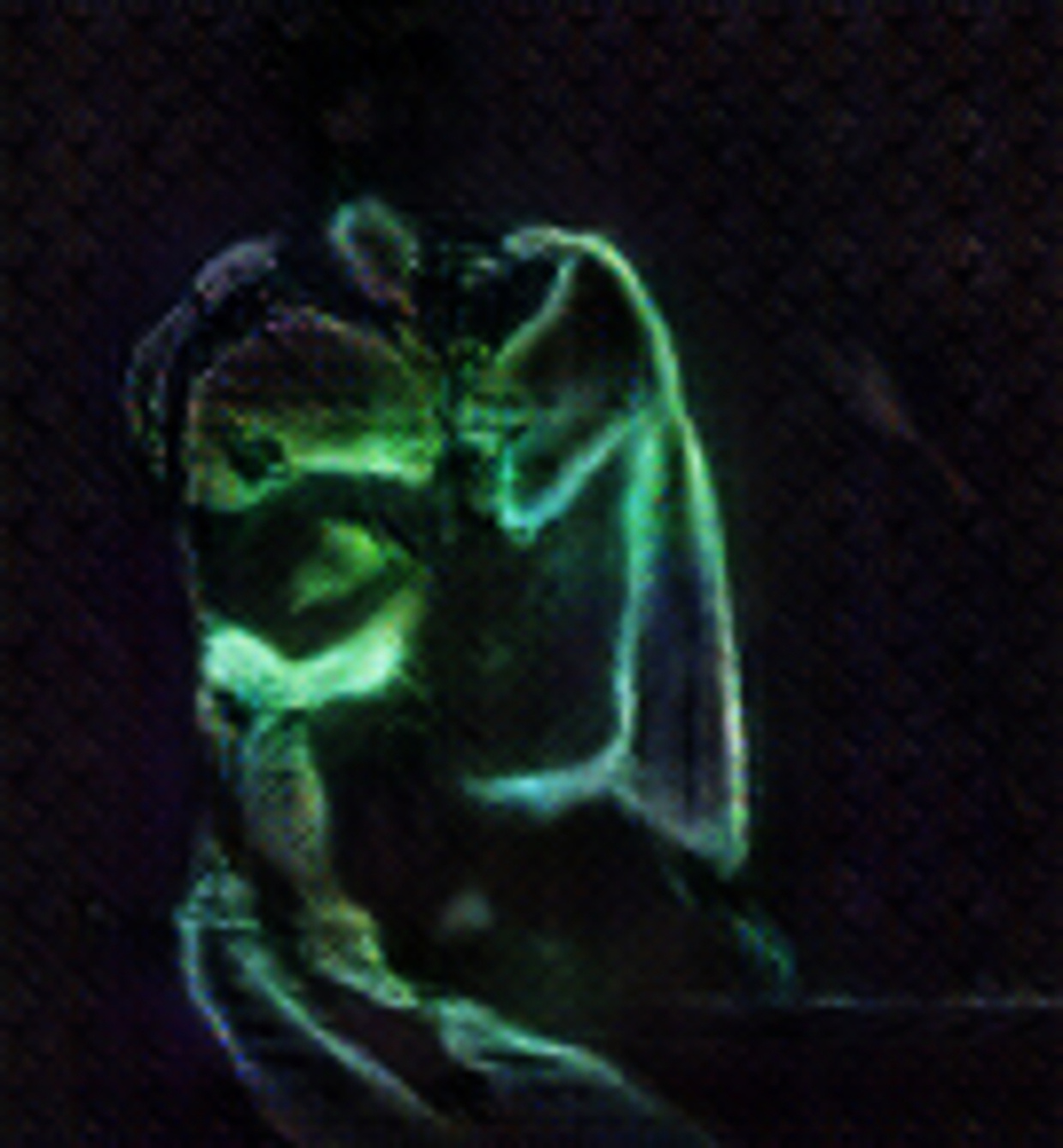 The Kiss