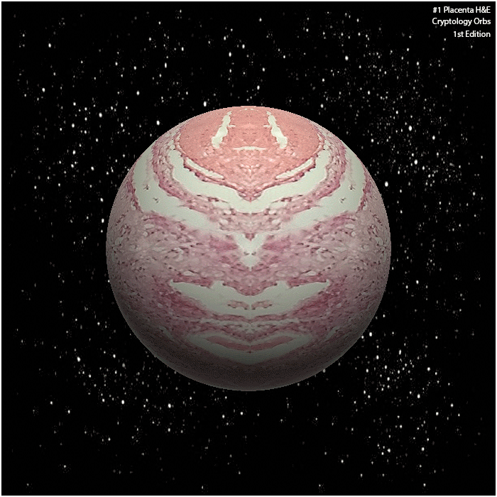 #1 Placenta [1st Edition] 