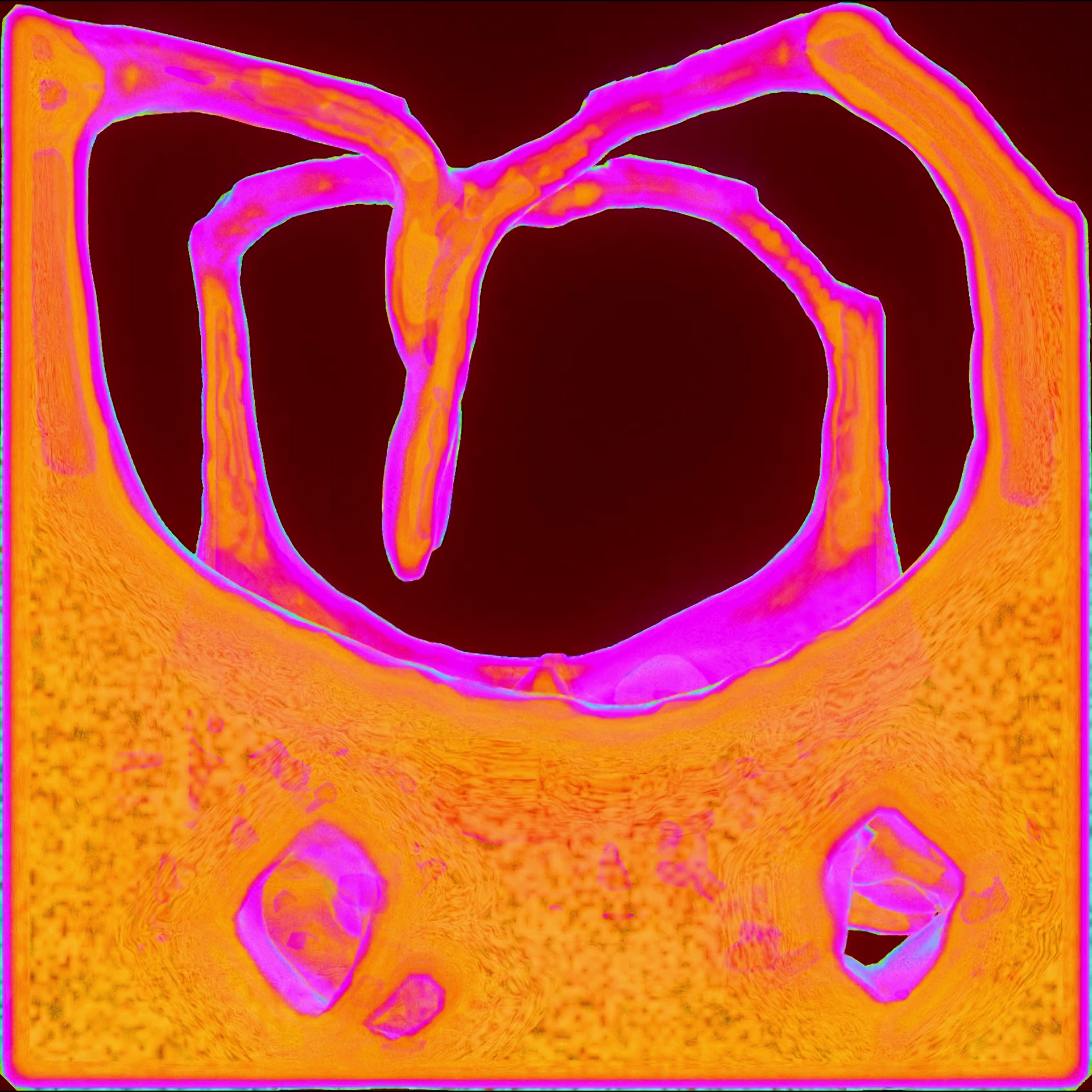 𝙾𝚅𝙴𝚁𝙼𝙰𝚃𝚃𝙴𝚁