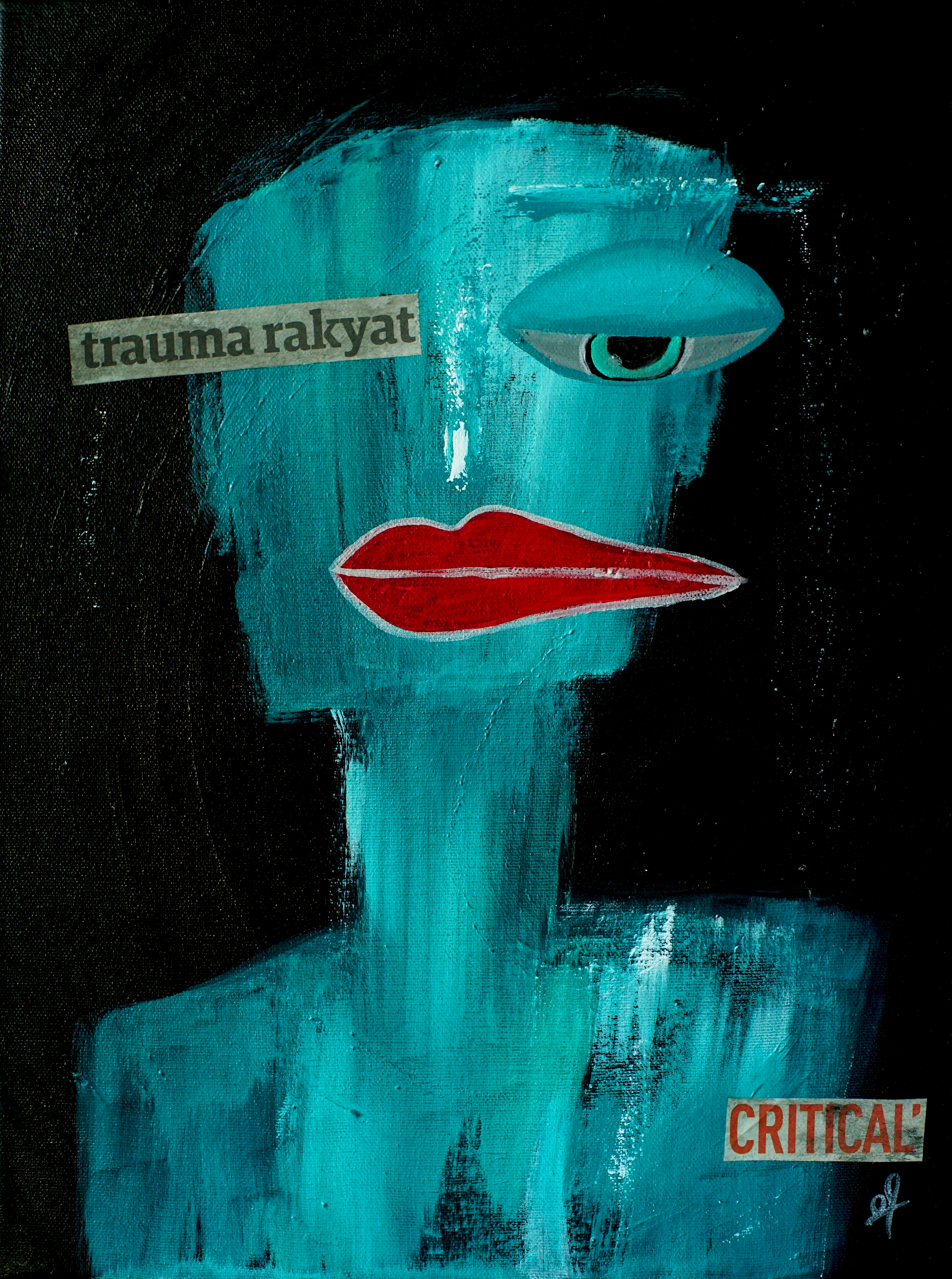 Trauma