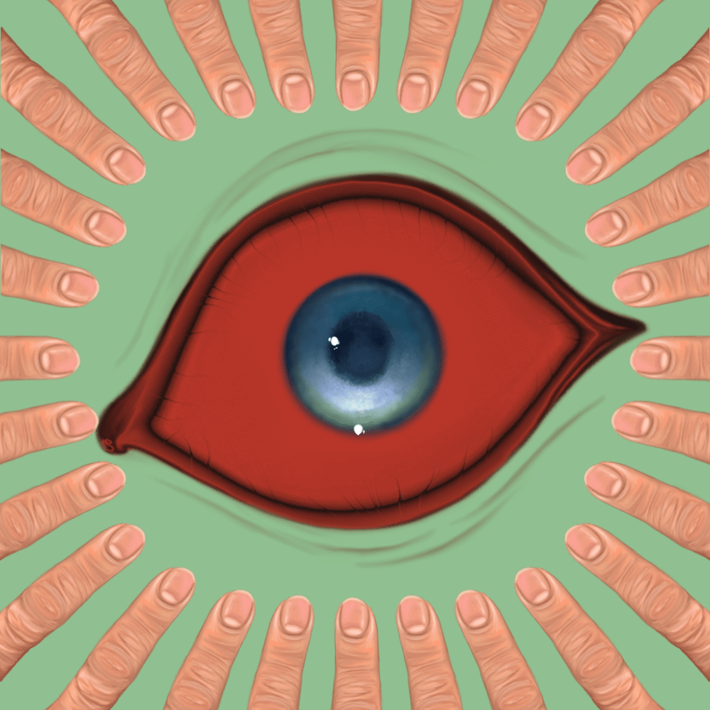 WATCHER #1421