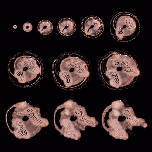 Embryogenesis #13